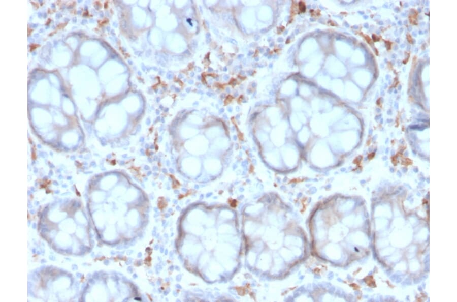 Immunohistochemistry - Anti-DC-SIGN Antibody [rC209/1781] (A248823) - Antibodies.com