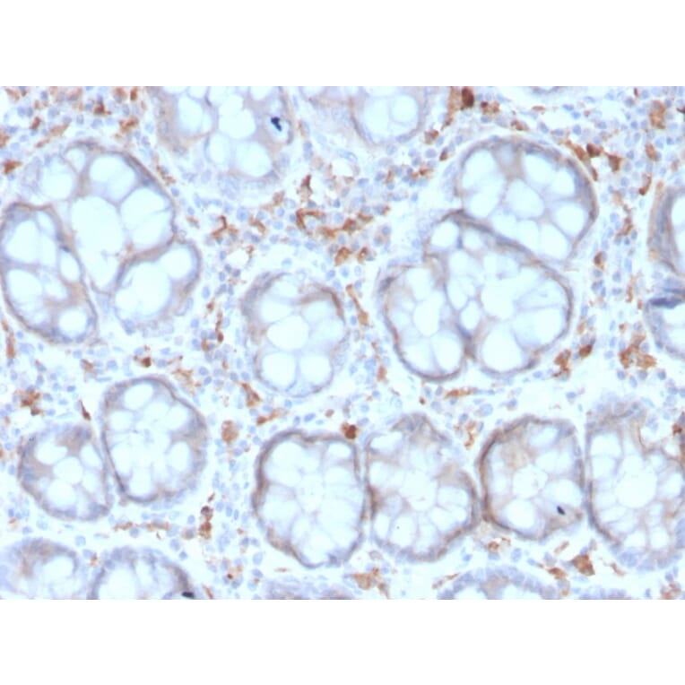 Immunohistochemistry - Anti-DC-SIGN Antibody [rC209/1781] (A248823) - Antibodies.com