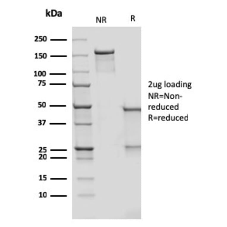 SDS-PAGE - Anti-DC-SIGN Antibody [rC209/1781] (A248823) - Antibodies.com
