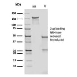 SDS-PAGE - Anti-DC-SIGN Antibody [rC209/1781] (A248823) - Antibodies.com