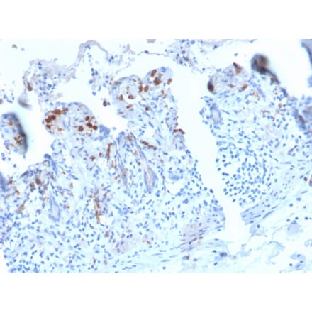 Immunohistochemistry - Anti-DC-SIGN Antibody [C209/2749R] (A248823) - Antibodies.com