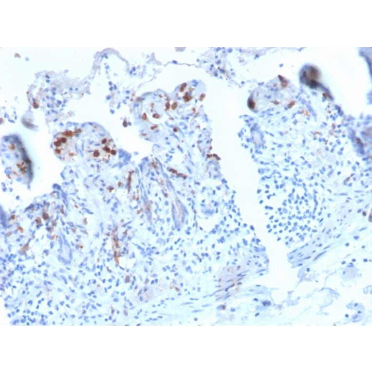 Immunohistochemistry - Anti-DC-SIGN Antibody [C209/2749R] (A248823) - Antibodies.com