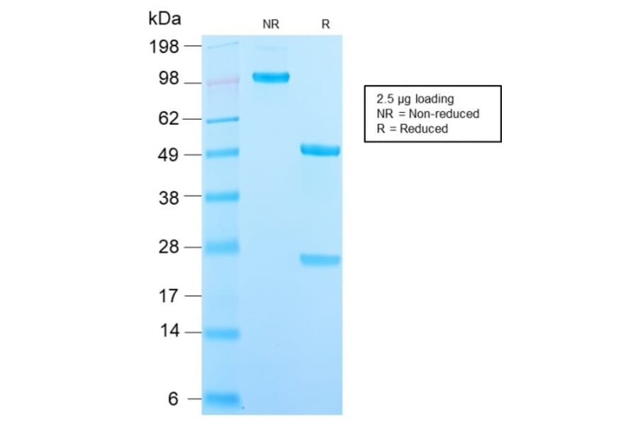 SDS-PAGE - Anti-DC-SIGN Antibody [C209/2749R] (A248824) - Antibodies.com