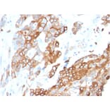 Immunohistochemistry - Anti-Heregulin Antibody [NRG1/2710] (A248825) - Antibodies.com