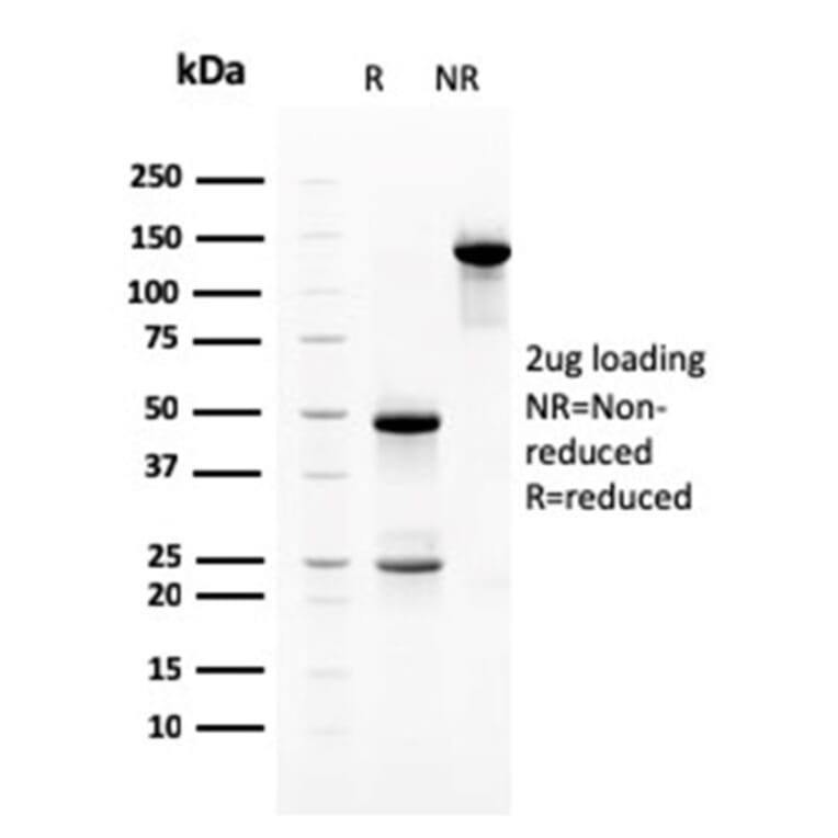 SDS-PAGE - Anti-Heregulin Antibody [NRG1/2710] (A248825) - Antibodies.com