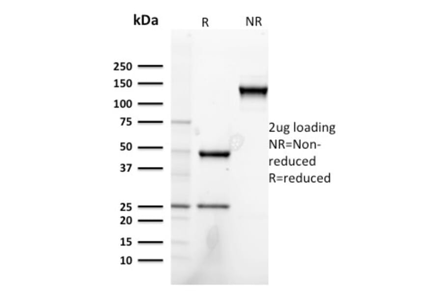 SDS-PAGE - Anti-Heregulin Antibody [NRG1/2752] (A248826) - Antibodies.com