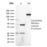 SDS-PAGE - Anti-Heregulin Antibody [NRG1/2752] (A248826) - Antibodies.com