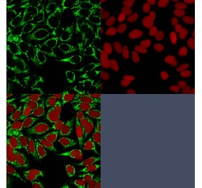 Immunofluorescence - Anti-HIF1 alpha Antibody [HIF1A/84] (A248826) - Antibodies.com