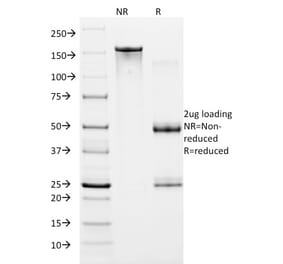 SDS-PAGE - Anti-HIF1 alpha Antibody [ESEE122] (A248827) - Antibodies.com