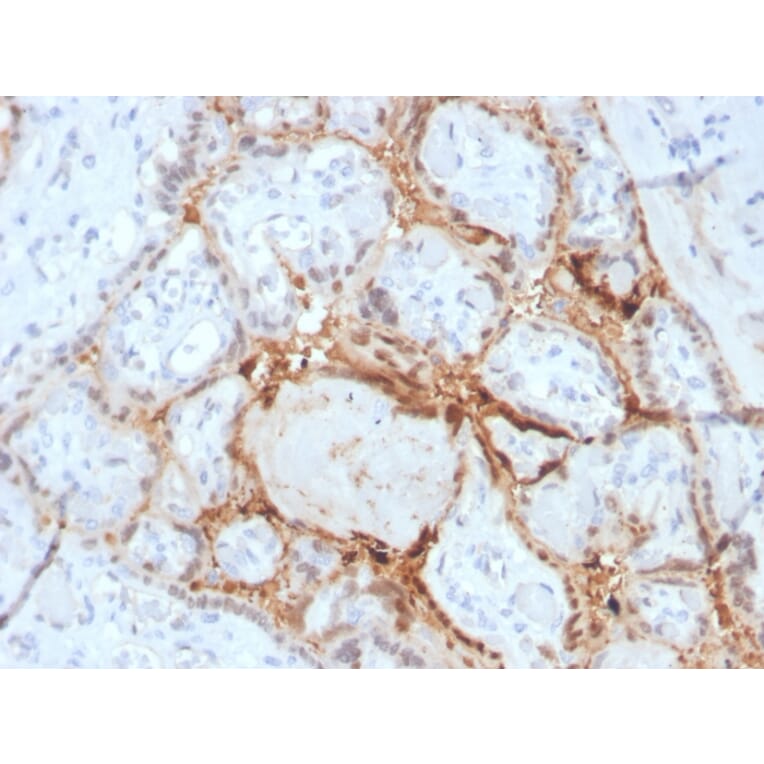 Immunohistochemistry - Anti-HIF1 alpha Antibody [Ha111a] (A248829) - Antibodies.com
