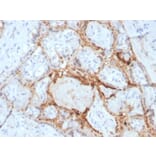 Immunohistochemistry - Anti-HIF1 alpha Antibody [Ha111a] (A248829) - Antibodies.com