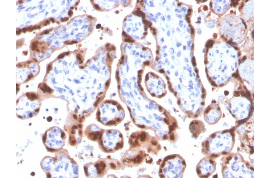 Immunohistochemistry - Anti-HIF1 alpha Antibody [Ha111a] (A248828) - Antibodies.com