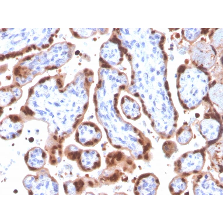 Immunohistochemistry - Anti-HIF1 alpha Antibody [Ha111a] (A248828) - Antibodies.com