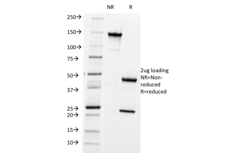 SDS-PAGE - Anti-HLA ABC Antibody [SPM419] (A248830) - Antibodies.com