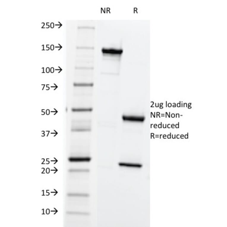 SDS-PAGE - Anti-HLA ABC Antibody [SPM419] (A248830) - Antibodies.com