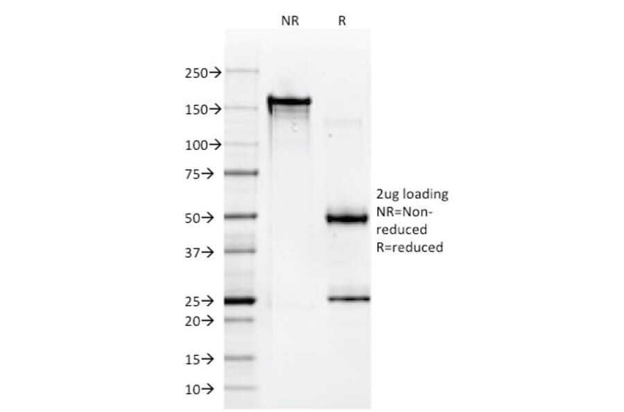 SDS-PAGE - Anti-HLA A Antibody [108-2C5] (A248832) - Antibodies.com