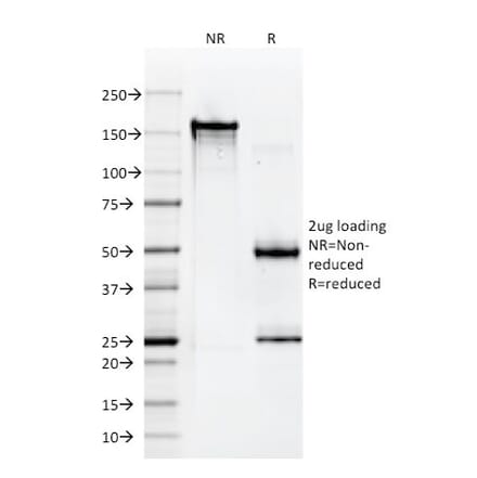 SDS-PAGE - Anti-HLA A Antibody [108-2C5] (A248832) - Antibodies.com