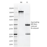 SDS-PAGE - Anti-HLA A Antibody [108-2C5] (A248832) - Antibodies.com