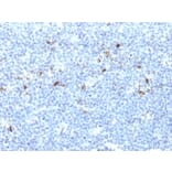 Immunohistochemistry - Anti-HLA Aw32 + HLA A25 Antibody [CATA-1] (A248832) - Antibodies.com