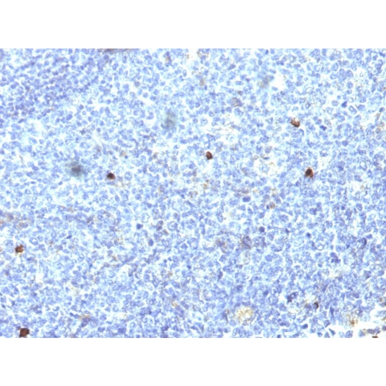 Immunohistochemistry - Anti-HLA Aw32 + HLA A25 Antibody [SPM418] (A248833) - Antibodies.com