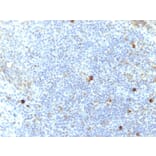 Immunohistochemistry - Anti-HLA Aw32 + HLA A25 Antibody [SPM417] (A248834) - Antibodies.com