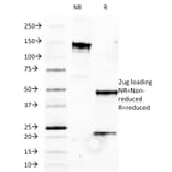 SDS-PAGE - Anti-HLA B Antibody [JOAN-1] (A248835) - Antibodies.com