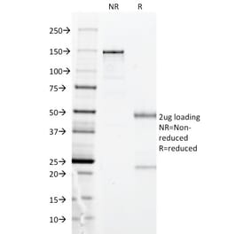 SDS-PAGE - Anti-HLA DP Antibody [BRA-FB6] (A248838) - Antibodies.com