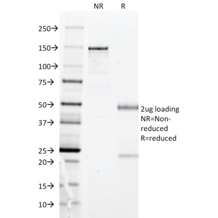 SDS-PAGE - Anti-HLA DP Antibody [BRA-FB6] (A248838) - Antibodies.com