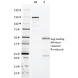 SDS-PAGE - Anti-HLA DP Antibody [BRA-FB6] (A248838) - Antibodies.com