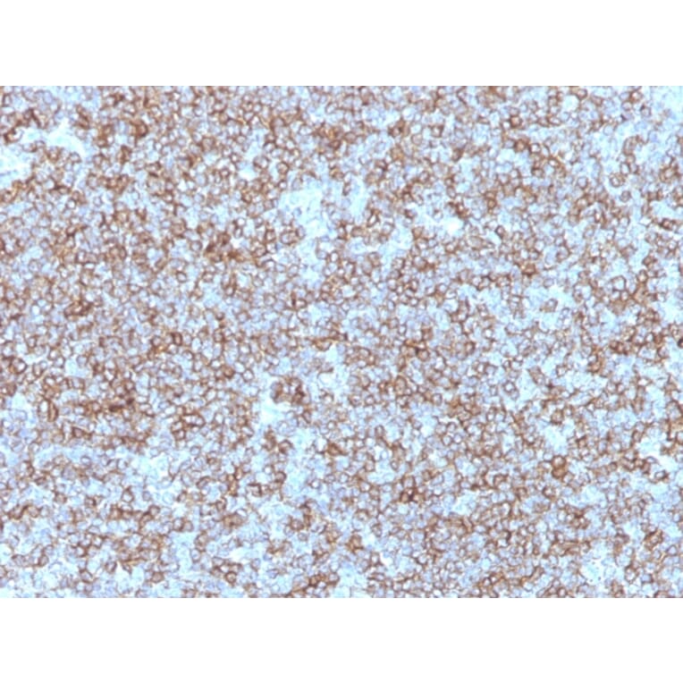 Immunohistochemistry - Anti-HLA DP + DR Antibody [Bra-14] (A248839) - Antibodies.com