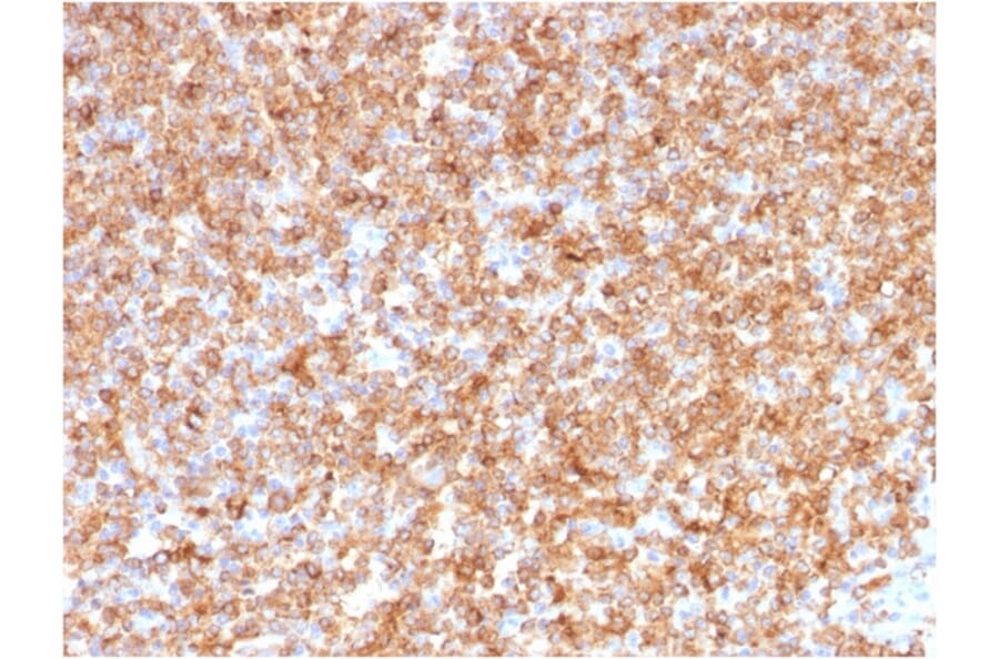 Immunohistochemistry - Anti-HLA DP + DQ + DR Antibody [CR3/43] (A248841) - Antibodies.com