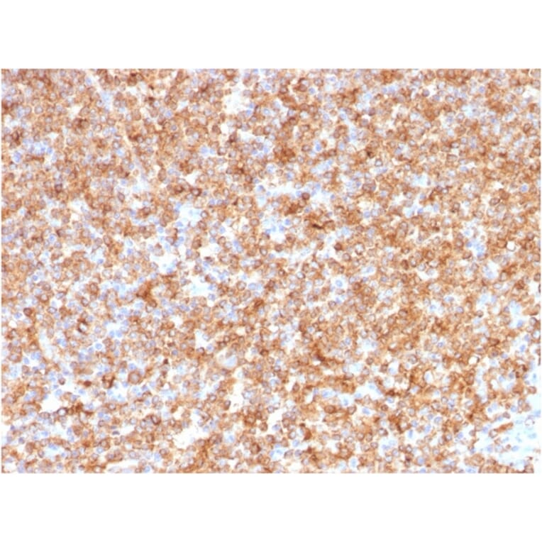 Immunohistochemistry - Anti-HLA DP + DQ + DR Antibody [CR3/43] (A248841) - Antibodies.com