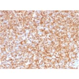 Immunohistochemistry - Anti-HLA DP + DQ + DR Antibody [CR3/43] (A248841) - Antibodies.com