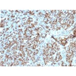 Immunohistochemistry - Anti-HLA DP + DQ + DR Antibody [CR3/43] (A248841) - Antibodies.com