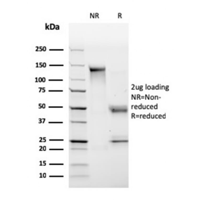 SDS-PAGE - Anti-HLA DP + DQ + DR Antibody [CR3/43] (A248841) - Antibodies.com
