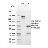 SDS-PAGE - Anti-HLA DP + DQ + DR Antibody [CR3/43] (A248841) - Antibodies.com