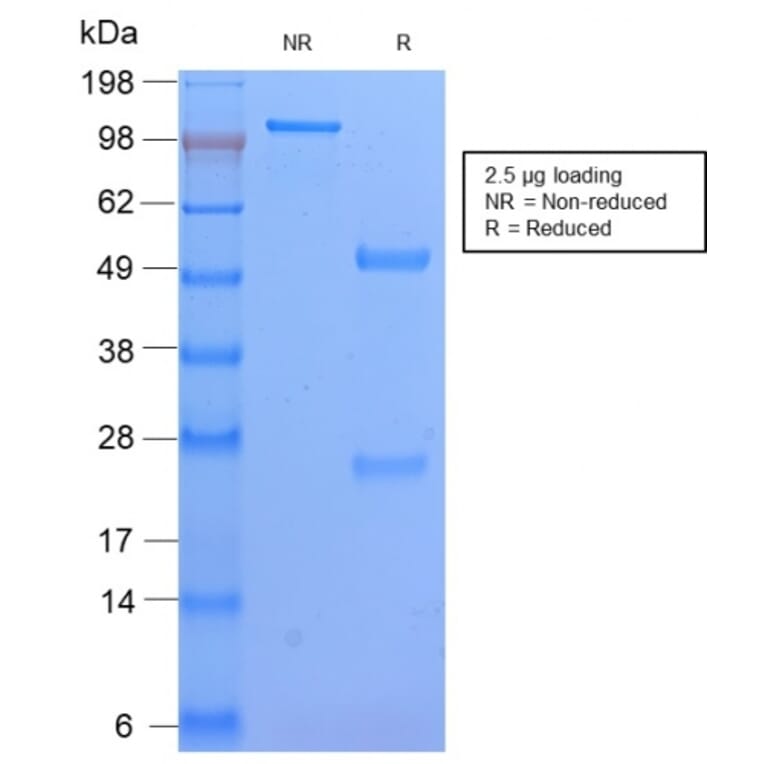 SDS-PAGE - Anti-HLA DP Antibody [HLA-DPB1/2862R] (A248842) - Antibodies.com
