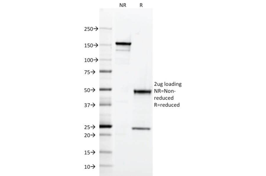 SDS-PAGE - Anti-HLA DQ Antibody [SPV-L3] (A248843) - Antibodies.com