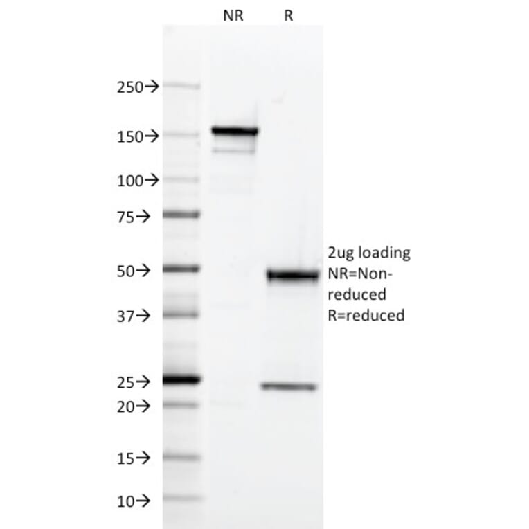 SDS-PAGE - Anti-HLA DQ Antibody [SPV-L3] (A248843) - Antibodies.com