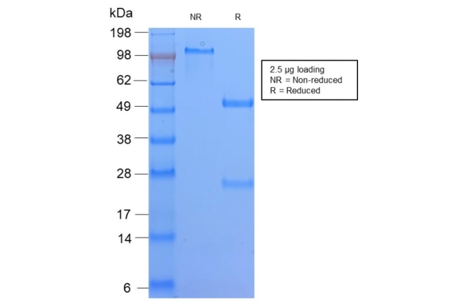 SDS-PAGE - Anti-HLA DQ Antibody [HLA-DQA1/2866R] (A248846) - Antibodies.com