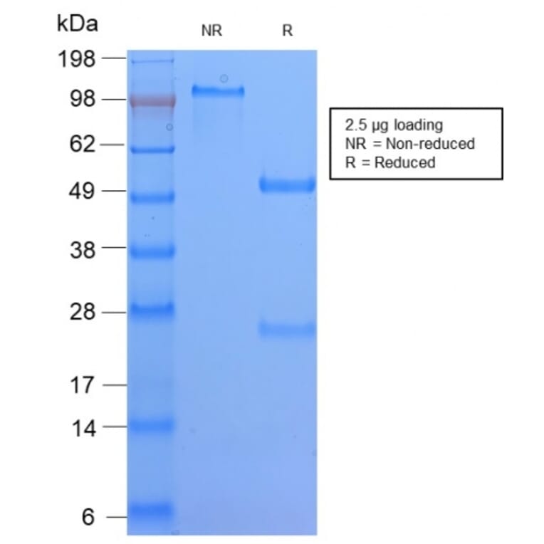 SDS-PAGE - Anti-HLA DQ Antibody [HLA-DQA1/2866R] (A248846) - Antibodies.com