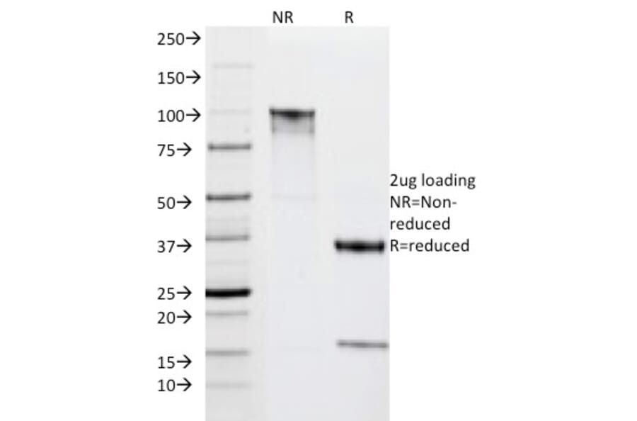SDS-PAGE - Anti-HLA DRA Antibody [IPO-10] (A248846) - Antibodies.com