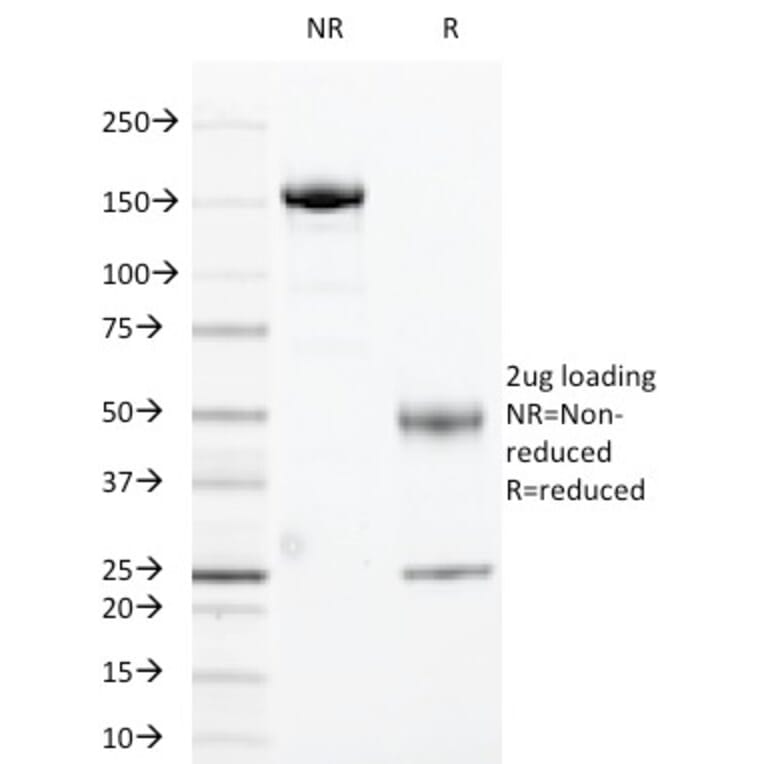 SDS-PAGE - Anti-HLA DRA Antibody [169-1B5.2] (A248848) - Antibodies.com