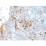 Immunohistochemistry - Anti-HLA DRA Antibody [19-26.1] (A248849) - Antibodies.com