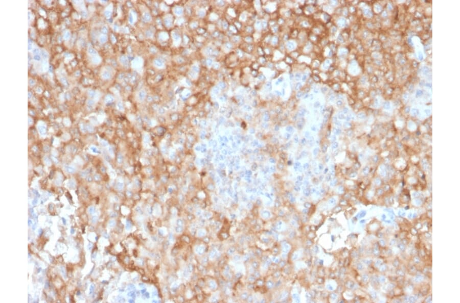 Immunohistochemistry - Anti-HLA DR Antibody [TAL 1B5] (A248850) - Antibodies.com