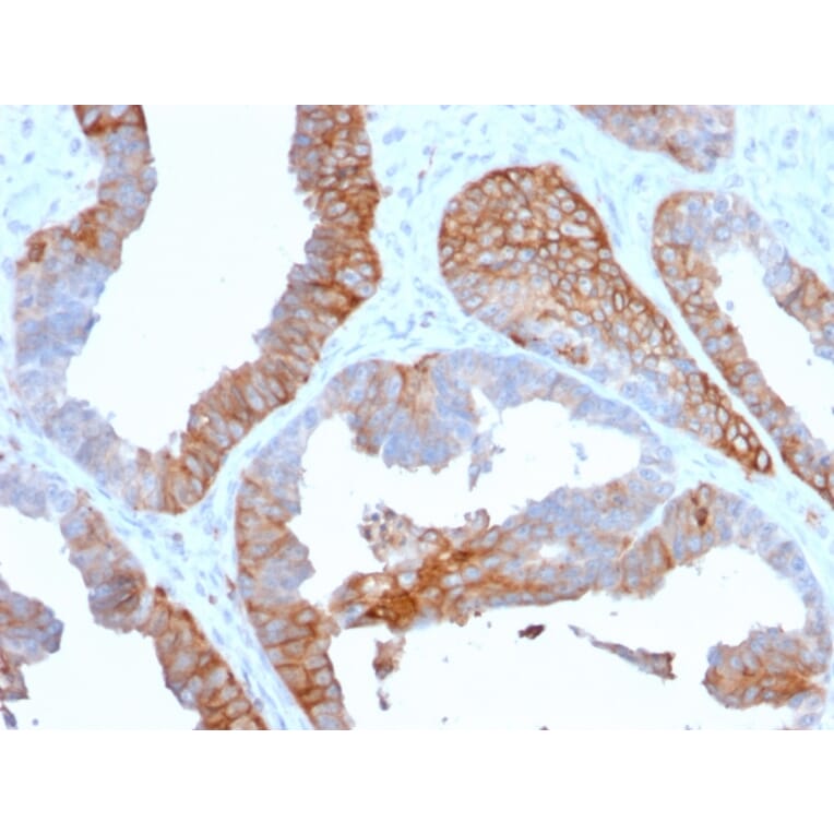 Immunohistochemistry - Anti-HLA DR Antibody [TAL 1B5] (A248850) - Antibodies.com