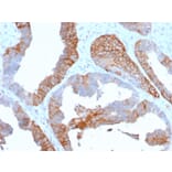 Immunohistochemistry - Anti-HLA DR Antibody [TAL 1B5] (A248850) - Antibodies.com