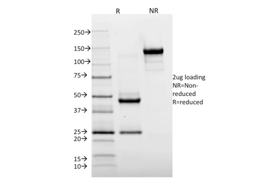 SDS-PAGE - Anti-HLA DR Antibody [TAL 1B5] (A248850) - Antibodies.com