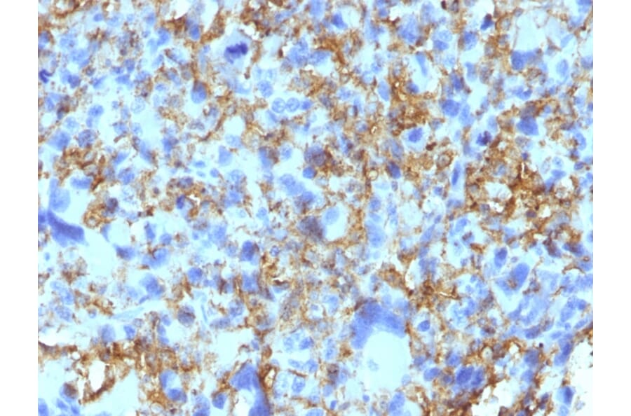 Immunohistochemistry - Anti-HLA DRB Antibody [LN-3] (A248851) - Antibodies.com