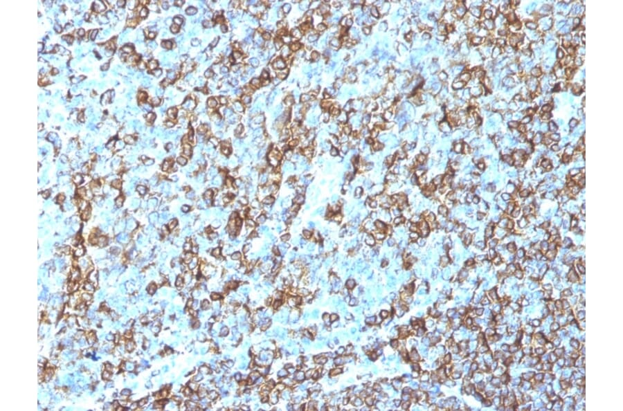 Immunohistochemistry - Anti-HLA DRB Antibody [LN-3] (A248851) - Antibodies.com